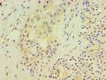 SRM Antibody in Immunohistochemistry (Paraffin) (IHC (P))