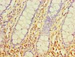 SRM Antibody in Immunohistochemistry (Paraffin) (IHC (P))