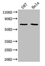 SUSD5 Antibody in Western Blot (WB)