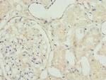 TAGLN2 Antibody in Immunohistochemistry (Paraffin) (IHC (P))