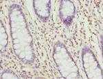 TAGLN2 Antibody in Immunohistochemistry (Paraffin) (IHC (P))