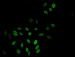 TBL1X Antibody in Immunocytochemistry (ICC/IF)