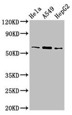 TBL1X Antibody in Western Blot (WB)