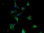 TCN2 Antibody in Immunocytochemistry (ICC/IF)