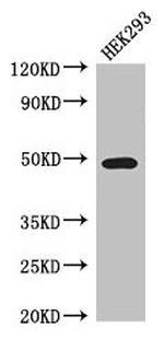 TCN2 Antibody in Western Blot (WB)