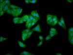 TFB1M Antibody in Immunocytochemistry (ICC/IF)