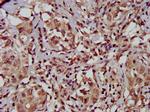 TFB1M Antibody in Immunohistochemistry (Paraffin) (IHC (P))