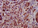 TFB1M Antibody in Immunohistochemistry (Paraffin) (IHC (P))