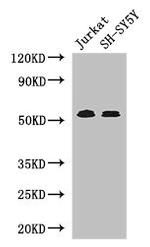 TGFBR1 Antibody in Western Blot (WB)