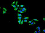 ENO1 Antibody in Immunocytochemistry (ICC/IF)