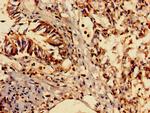 ENO1 Antibody in Immunohistochemistry (Paraffin) (IHC (P))