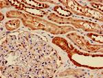 ENO1 Antibody in Immunohistochemistry (Paraffin) (IHC (P))