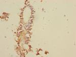 TNFAIP8 Antibody in Immunohistochemistry (Paraffin) (IHC (P))