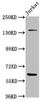 Tankyrase Antibody in Western Blot (WB)