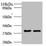 TPSB2 Antibody in Western Blot (WB)