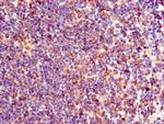 TXK Antibody in Immunohistochemistry (Paraffin) (IHC (P))