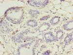 UBE2D1 Antibody in Immunohistochemistry (Paraffin) (IHC (P))