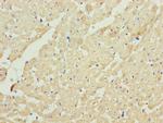 UQCRC2 Antibody in Immunohistochemistry (Paraffin) (IHC (P))