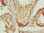 UQCRC2 Antibody in Immunohistochemistry (Paraffin) (IHC (P))