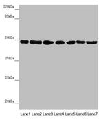 UQCRC2 Antibody in Western Blot (WB)