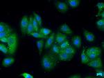 ZFYVE9 Antibody in Immunocytochemistry (ICC/IF)