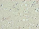 ZNF821 Antibody in Immunohistochemistry (Paraffin) (IHC (P))