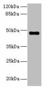 ZNF821 Antibody in Western Blot (WB)