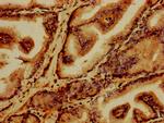 GABARAPL2 Antibody in Immunohistochemistry (Paraffin) (IHC (P))