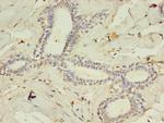 ACSL4 Antibody in Immunohistochemistry (Paraffin) (IHC (P))