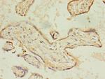 ACSL4 Antibody in Immunohistochemistry (Paraffin) (IHC (P))