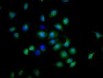 CD137 (4-1BB) Antibody in Immunocytochemistry (ICC/IF)