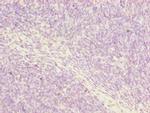 Periostin Antibody in Immunohistochemistry (Paraffin) (IHC (P))