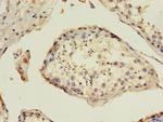 TIM-1 Antibody in Immunohistochemistry (Paraffin) (IHC (P))