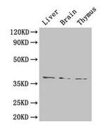 TIM-1 Antibody in Western Blot (WB)