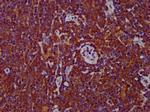 ADAM8 Antibody in Immunohistochemistry (Paraffin) (IHC (P))