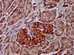 ADAM8 Antibody in Immunohistochemistry (Paraffin) (IHC (P))