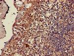 CD3z Antibody in Immunohistochemistry (Paraffin) (IHC (P))