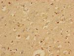 PAI1 Antibody in Immunohistochemistry (Paraffin) (IHC (P))