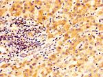 TGM2 Antibody in Immunohistochemistry (Paraffin) (IHC (P))