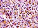 PRSS3 Antibody in Immunohistochemistry (Paraffin) (IHC (P))