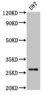 PRSS3 Antibody in Western Blot (WB)