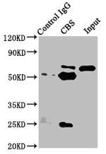 CBS Antibody in Western Blot (WB)