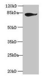 gamma Catenin Antibody in Western Blot (WB)