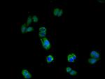 IL17RA Antibody in Immunocytochemistry (ICC/IF)