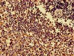 HLA-B Antibody in Immunohistochemistry (Paraffin) (IHC (P))