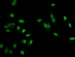 MLH1 Antibody in Immunocytochemistry (ICC/IF)