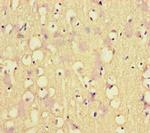 MLH1 Antibody in Immunohistochemistry (Paraffin) (IHC (P))