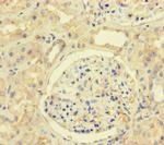 MLH1 Antibody in Immunohistochemistry (Paraffin) (IHC (P))