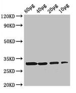 RBKS Antibody in Western Blot (WB)