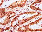 CABIN1 Antibody in Immunohistochemistry (Paraffin) (IHC (P))